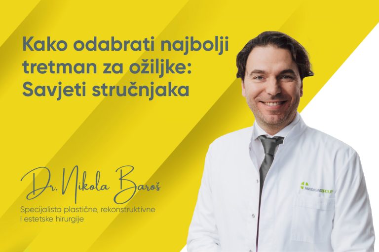Savjeti stručnjaka za odabir najboljeg tretmana za ožiljke